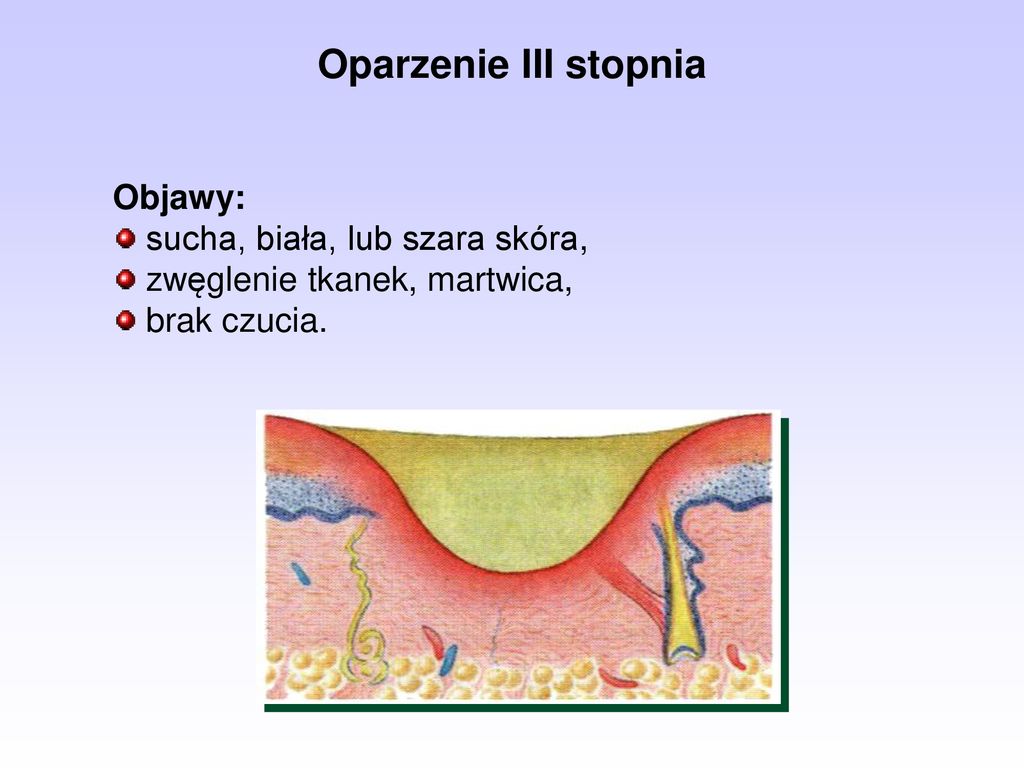 Kurs Stra K W Ratownik W Osp Temat Elementy Pierwszej Pomocy Ppt